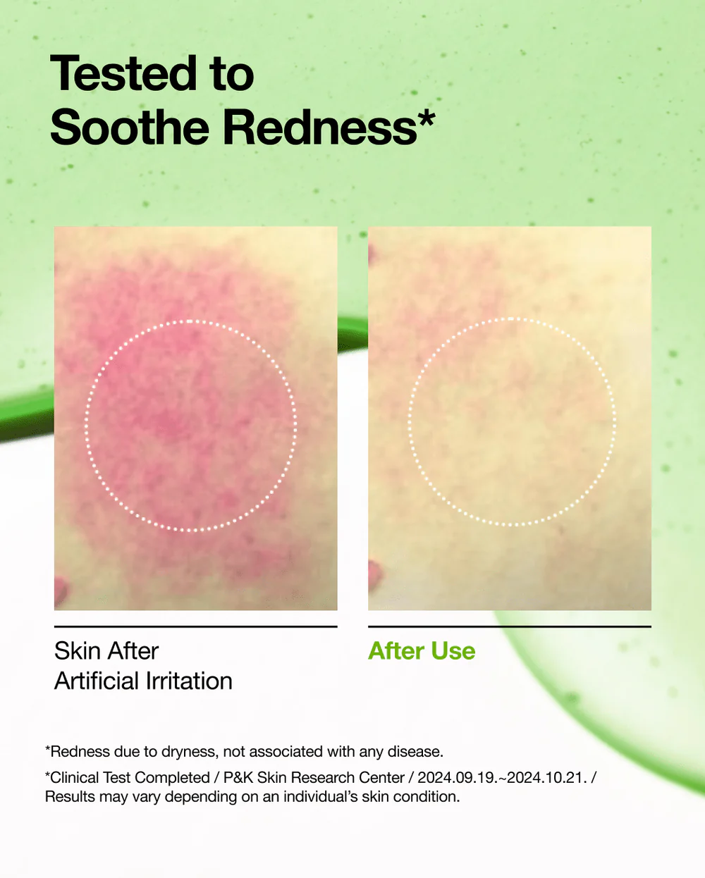 AZELAIC HYALURON SOOTHING SERUM 30ML